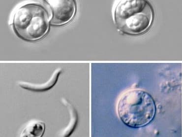 OSDH Shares Information on Increase of Cyclosporiasis in the United States and in Oklahoma image